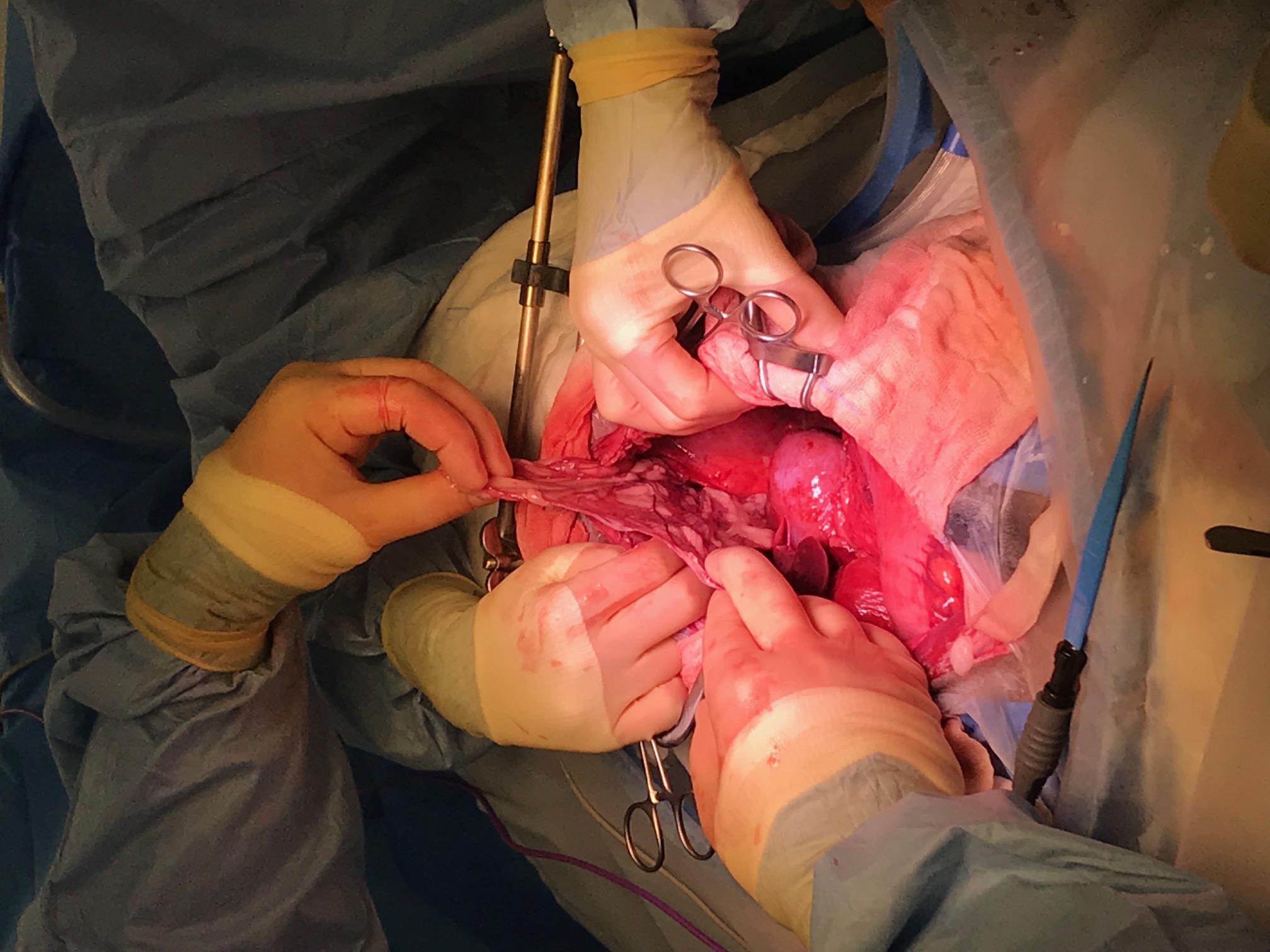 Congenital defect complicating a case of septic peritonitis in a Labrador