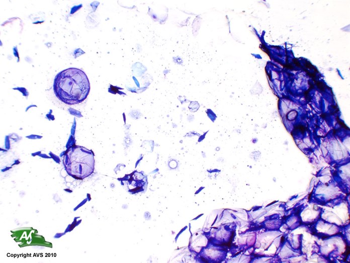 SUBCUTIS FNA, Dog, Lipoma Veterinary Pathology & Cytology