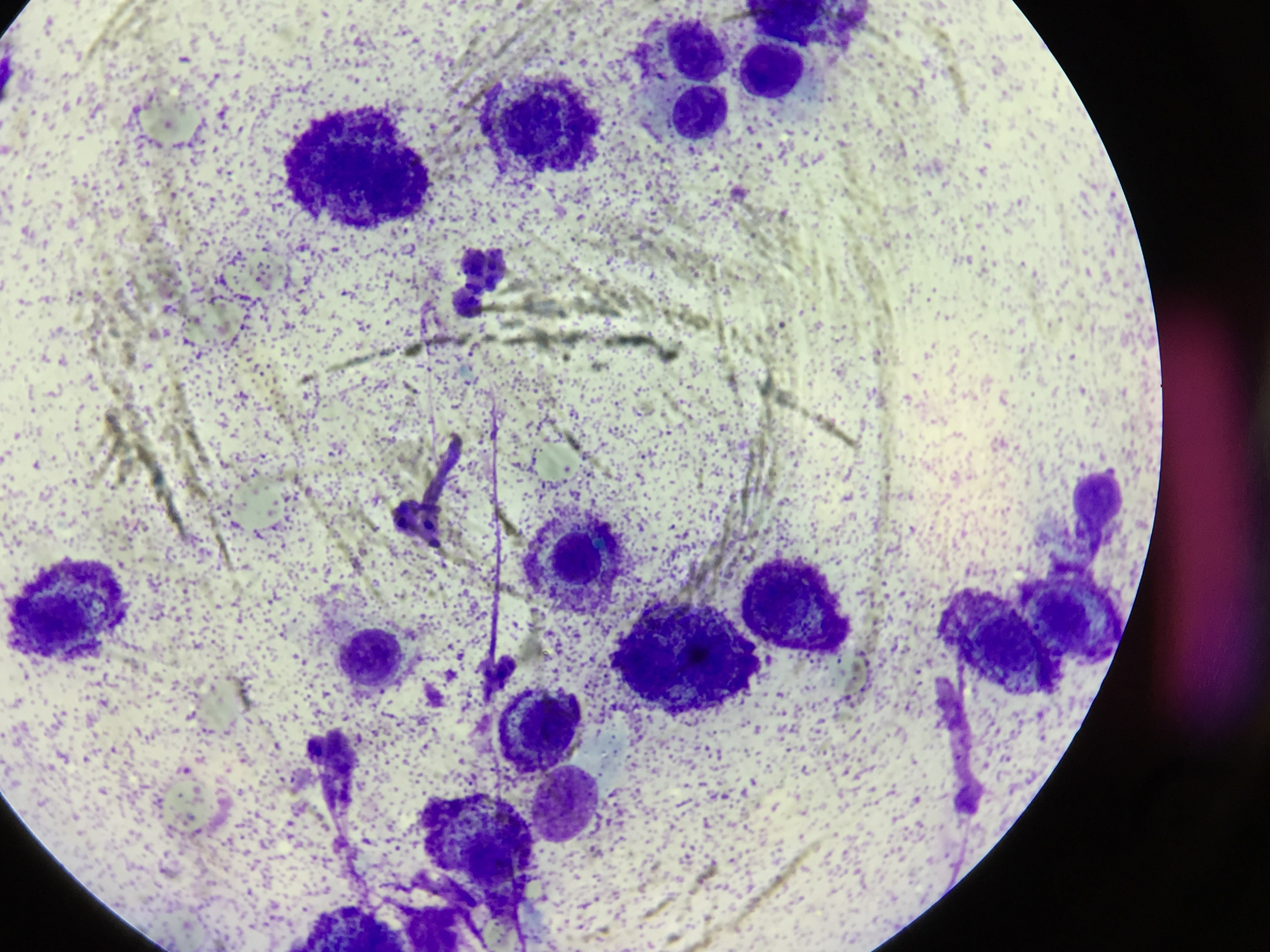 Mast Cell Tumour
