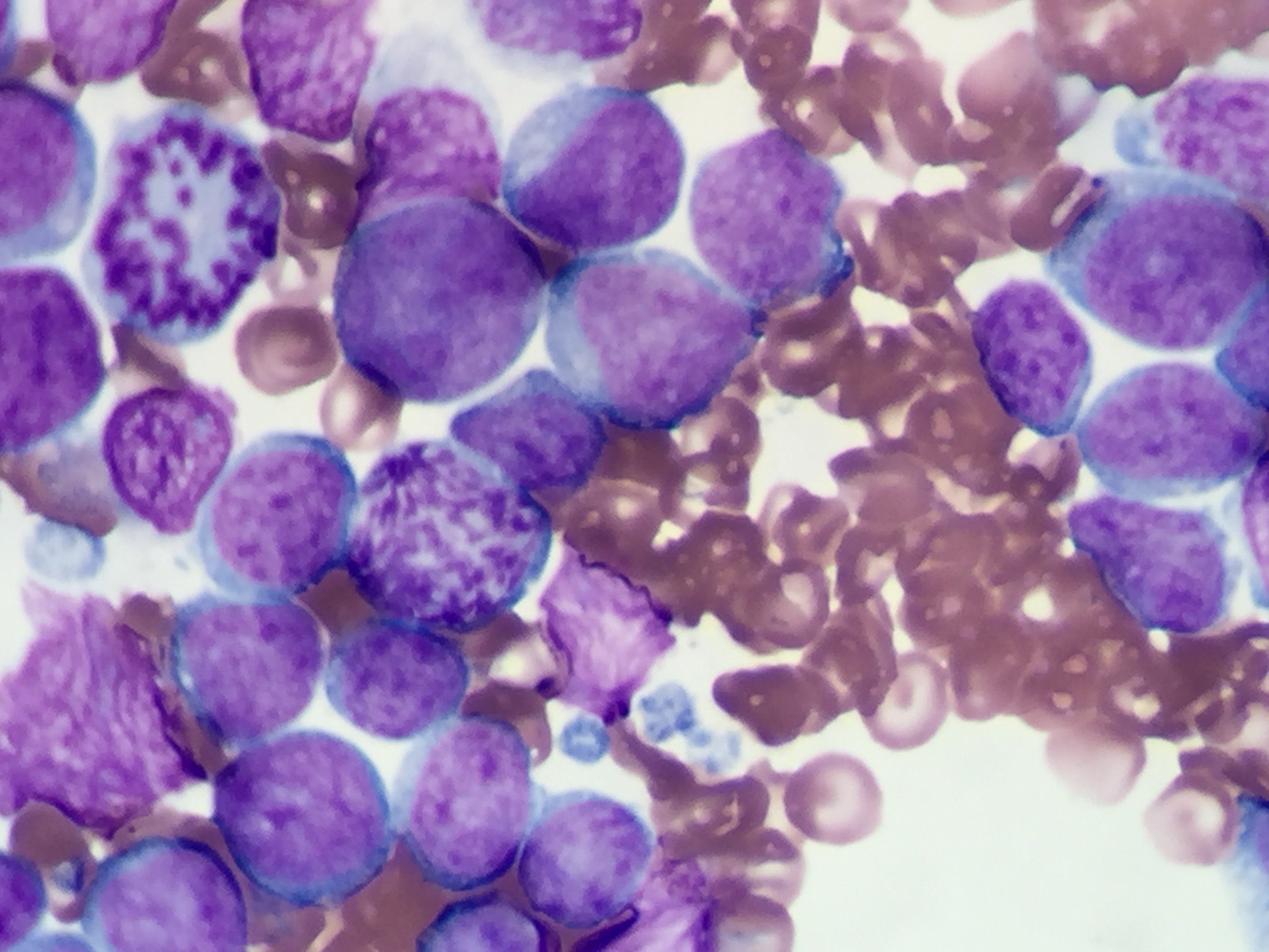 Mitotic Figures