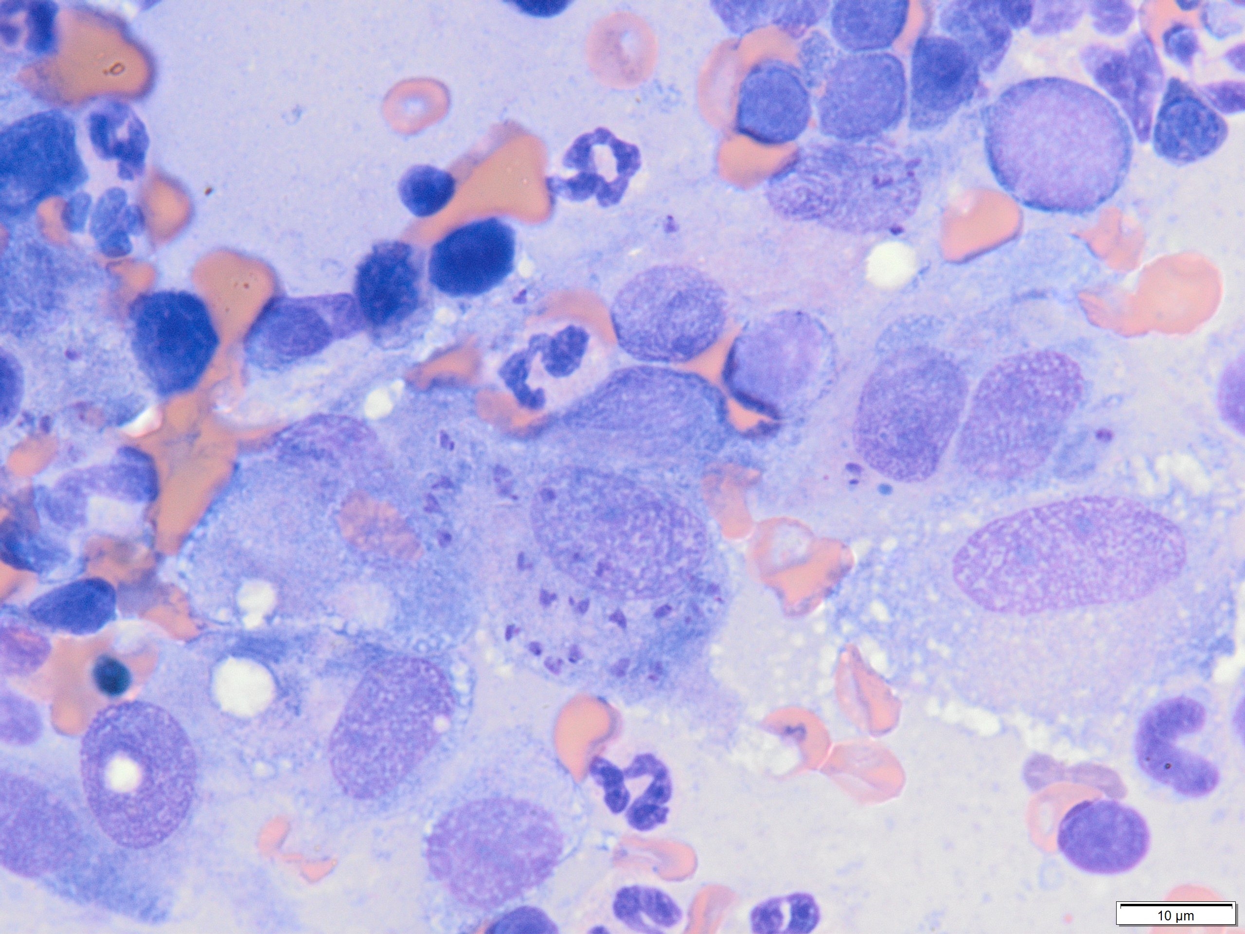 Leishmania species amastigotes