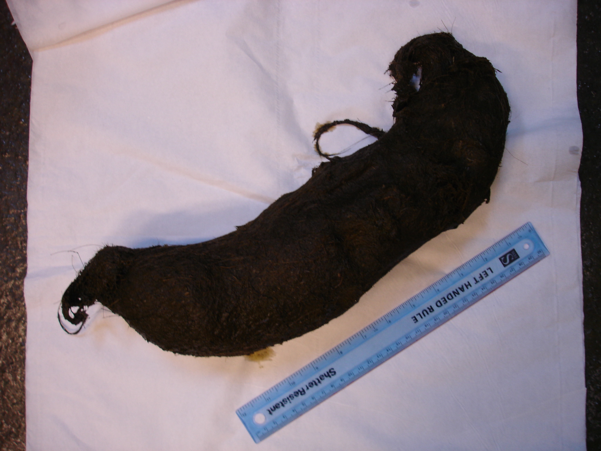 Trichobezoar