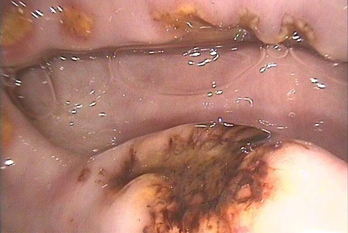 The new equine Veterinary Journal UK Vet: Equine has published new evidence-based guidelines on the management of equine glandular gastric disease (EGGD) which publishers say could help improve management of the condition in practice.