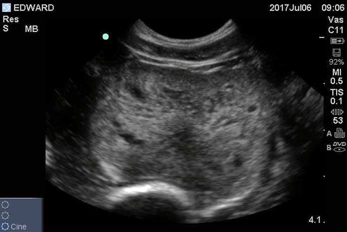 Photo: Ultrasound of dog with prostatic disease