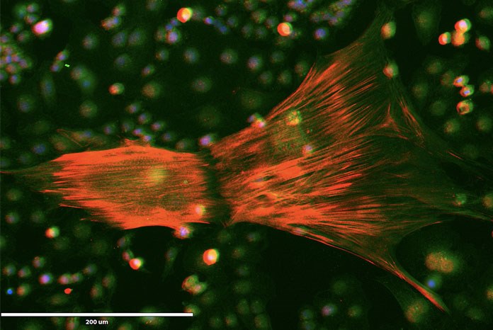 pluripotent stem cells