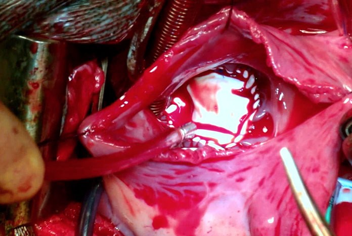 The Royal Veterinary College has performed world-first surgery to correct a combination of congenital heart defects in a dog that required a repair to its tricuspid valve and common atrium. 