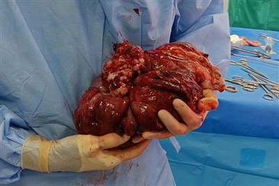 Paragon vets remove 5kg monster of a tumour from Dalmatian