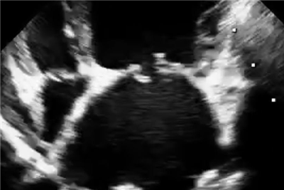 Should you treat preclinical canine MMVD with ACEIs?
