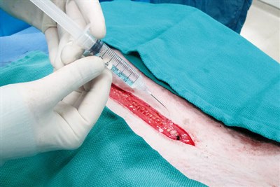 New JSAP review discusses use of intraperitoneal and incisional analgesia