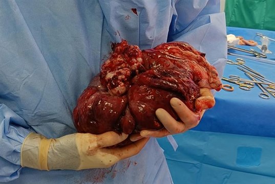 Paragon vets remove 5kg monster of a tumour from Dalmatian